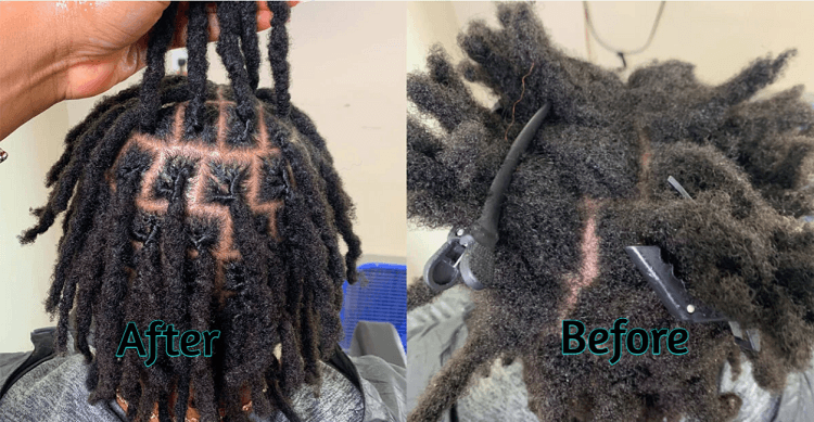 Interlocking Dreads and Locs Care